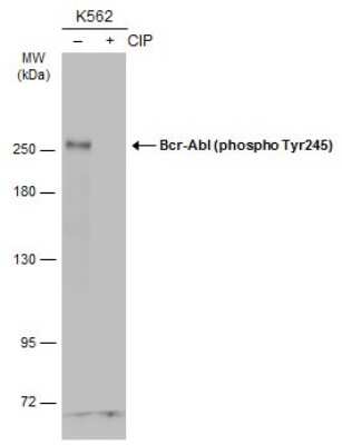 Western Blot: c-Abl [p Tyr245] Antibody [NBP3-13326]